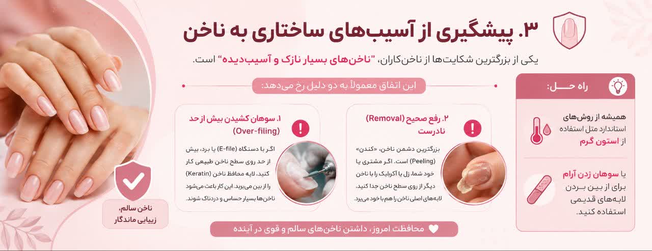 پیشگیری از آسیب‌های ساختاری به ناخن